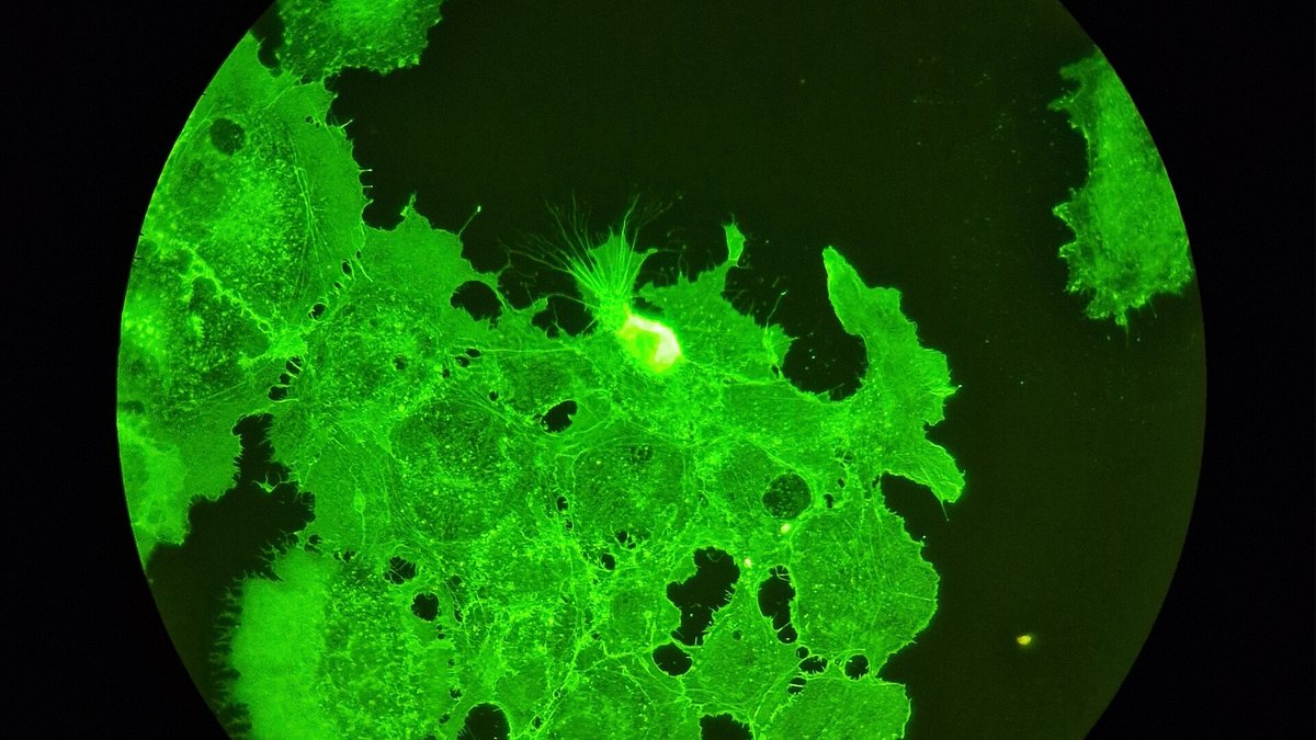 Fluorescence micrograph of living cells lit up in green — the visual language of redox-signalling research, where reactive oxygen species such as the hydroperoxyl radical HO2 act as messengers, studied by Panacea Bio Chem and Bogdan Dicoias